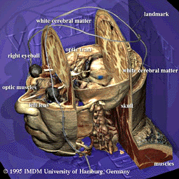 Diffuse Border between Life and Death